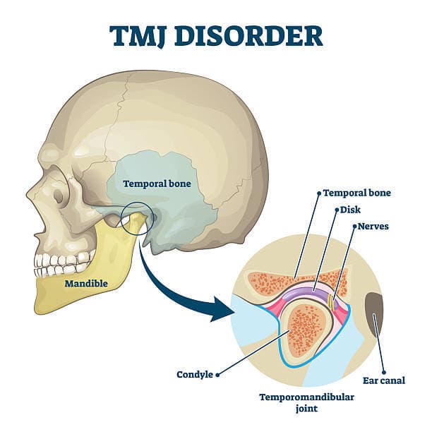 TMJ Treatment: Beyond Basic Jaw Exercises