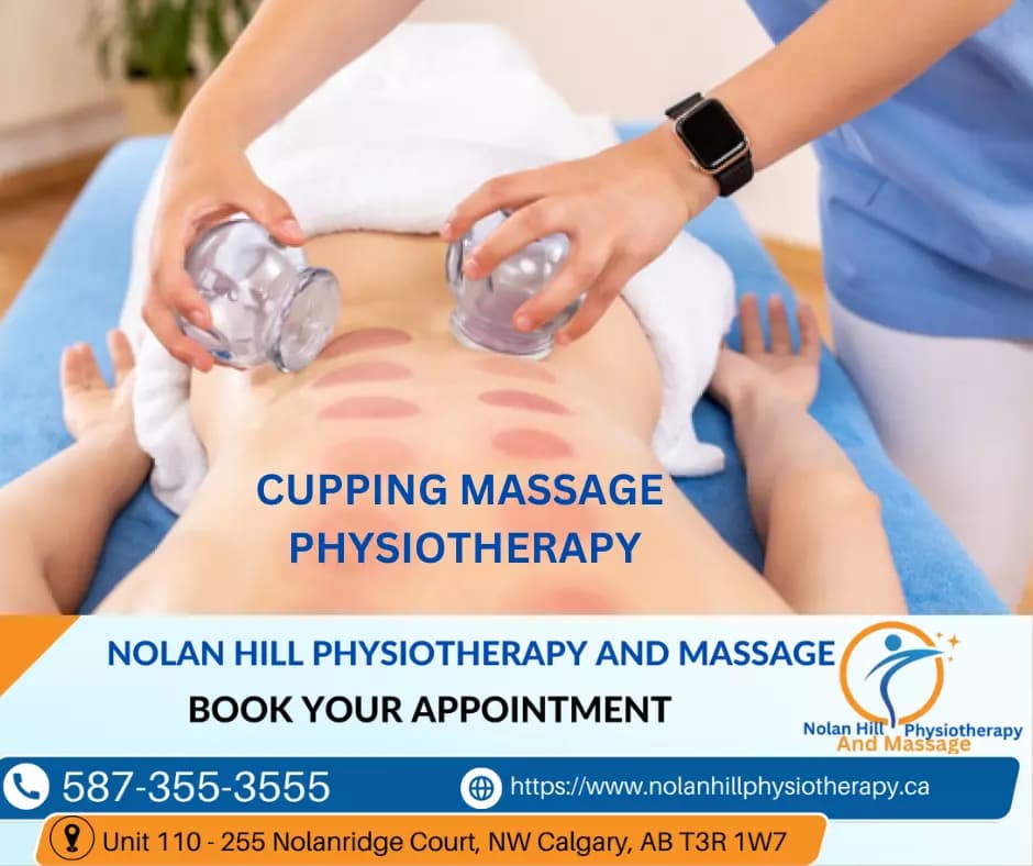 Cupping Massage Therapy in NW Calgary at Nolan Hill Physiotherapy & Massage NW Calgary