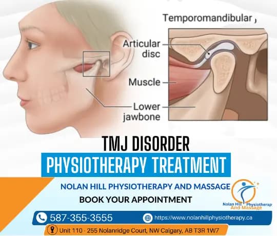 TMJ Physiotherapy in NW Calgary — Jaw Pain Relief at Nolan Hill Physiotherapy & Massage NW Calgary